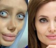 Sahar Tabar, la joven que se sometió a más de 50 operaciones para ser como Angelina Jolie