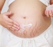 Las mejores cremas para evitar las estrías del embarazo