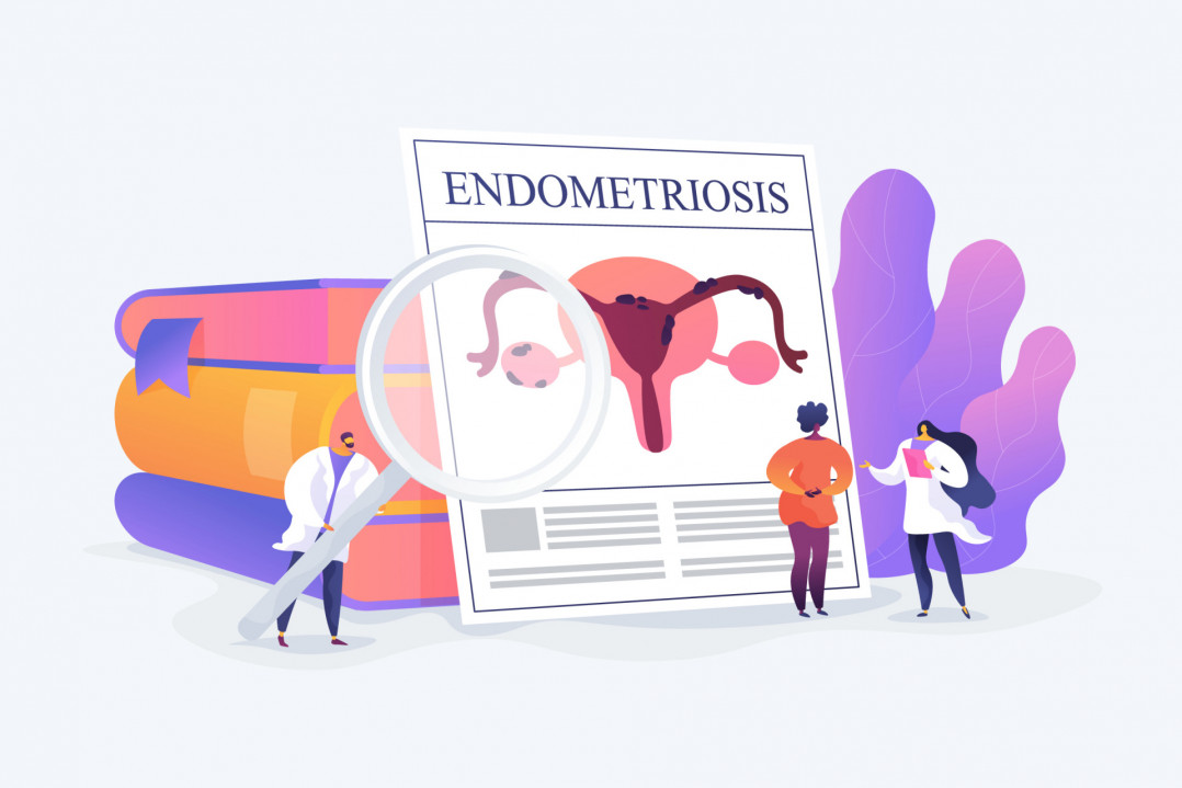Lo que debemos saber sobre la endometriosis