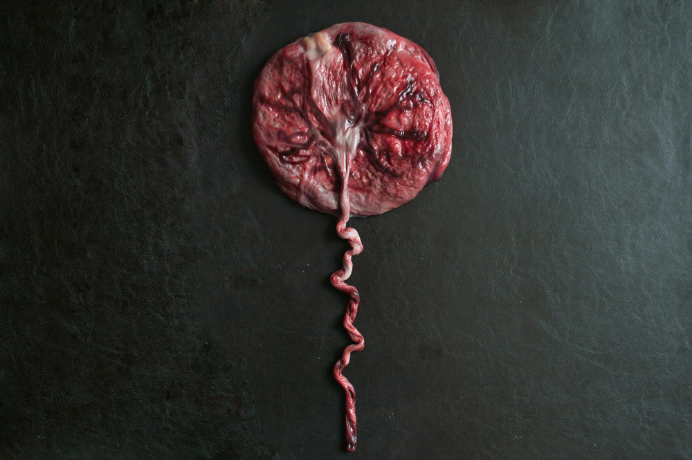 Mi amiga la que se comi&oacute; su placenta