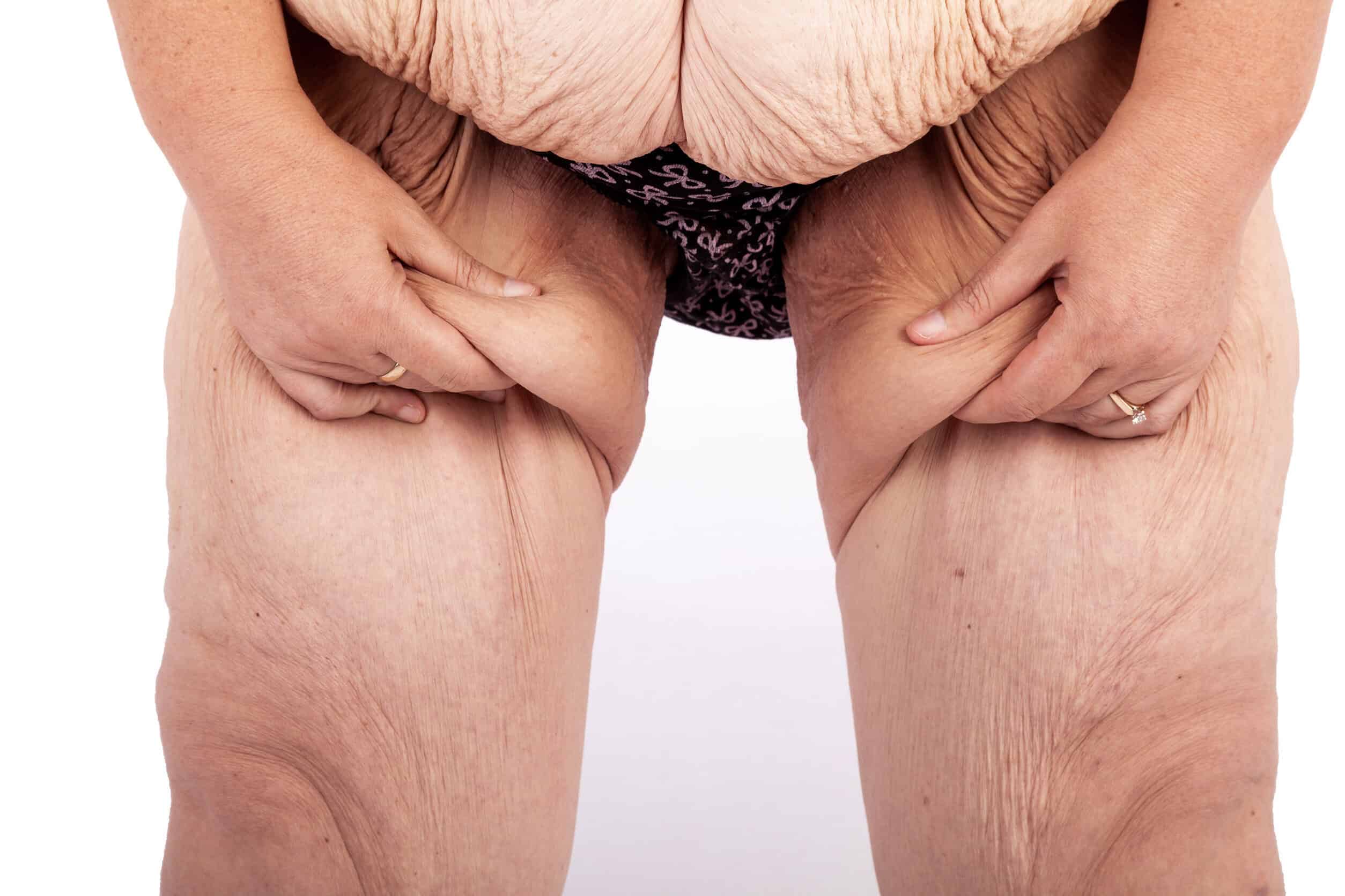 Ning&uacute;n t&iacute;o me hab&iacute;a hecho sentir mal por mi cuerpo. Hasta que adelgac&eacute;.