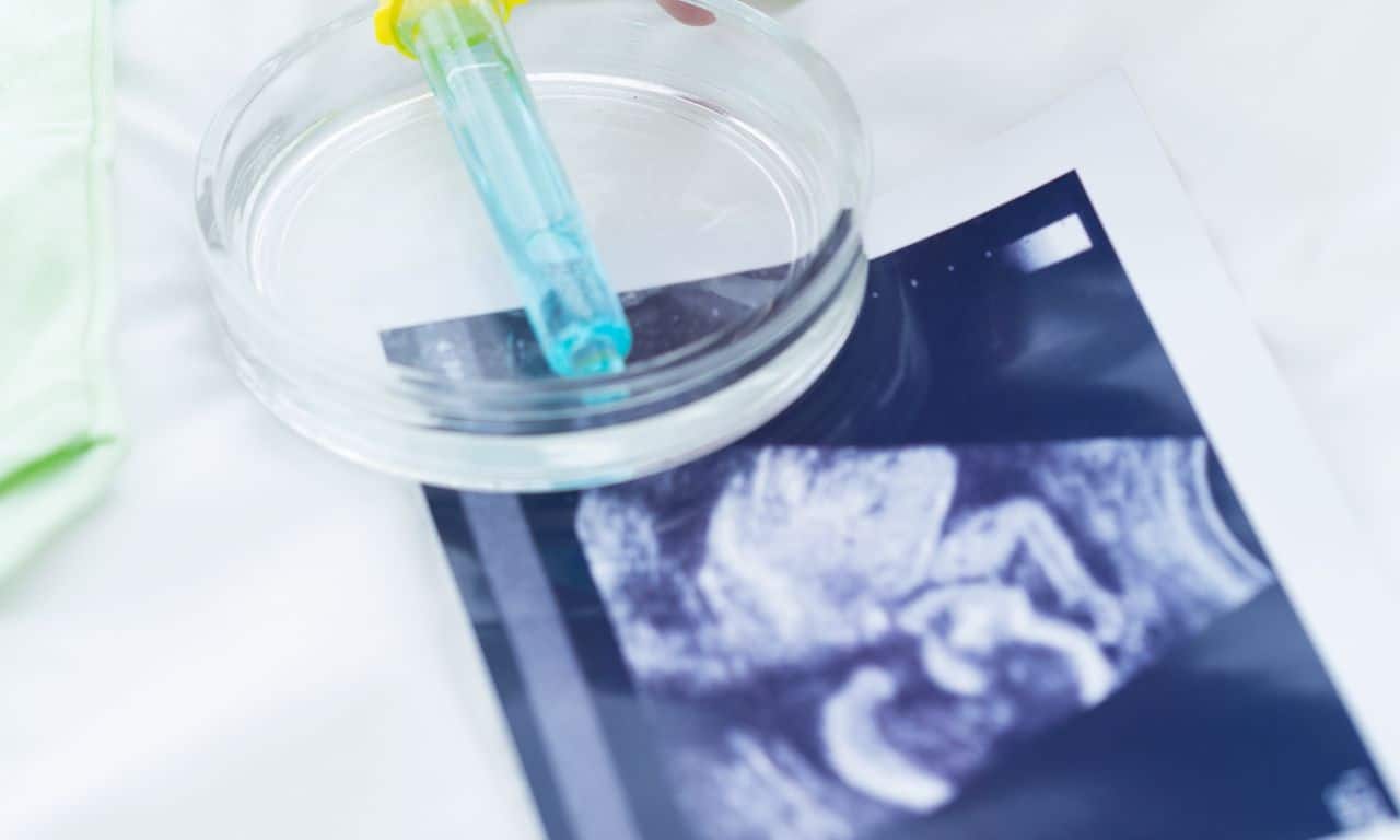 &iquest;Cu&aacute;ndo y por qu&eacute; hacerse una prueba de fertilidad femenina?